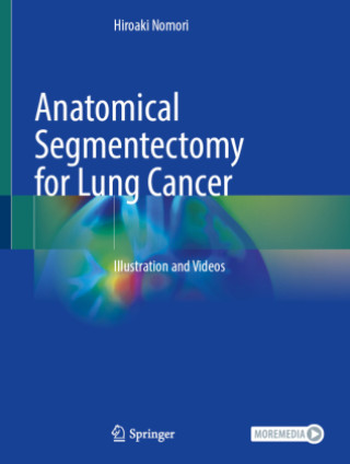 Libro Anatomical Segmentectomy for Lung Cancer Hiroaki Nomori