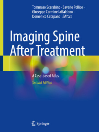 Könyv Imaging Spine After Treatment Tommaso Scarabino