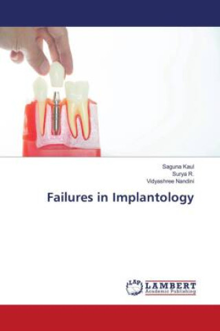Kniha Failures in Implantology Surya R.