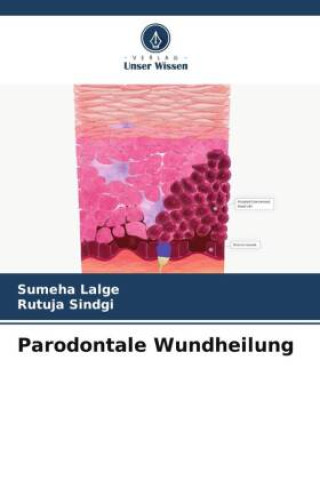 Carte Parodontale Wundheilung Rutuja Sindgi