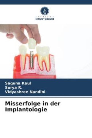 Kniha Misserfolge in der Implantologie Surya R.
