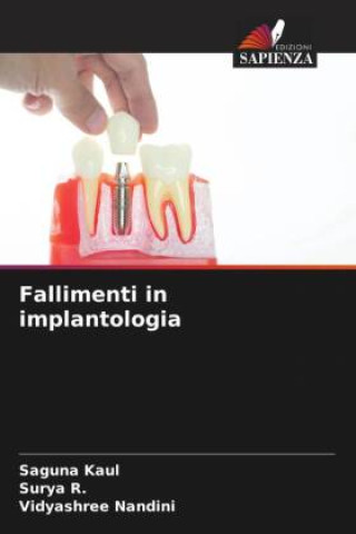 Kniha Fallimenti in implantologia Surya R.