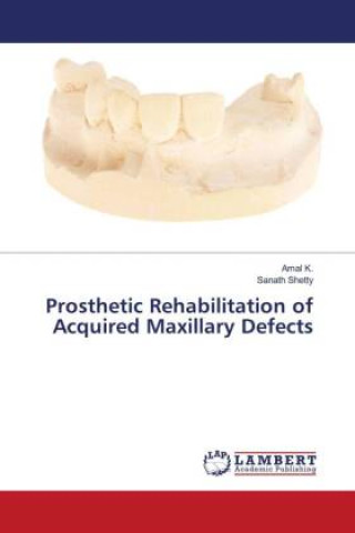 Kniha Prosthetic Rehabilitation of Acquired Maxillary Defects Sanath Shetty