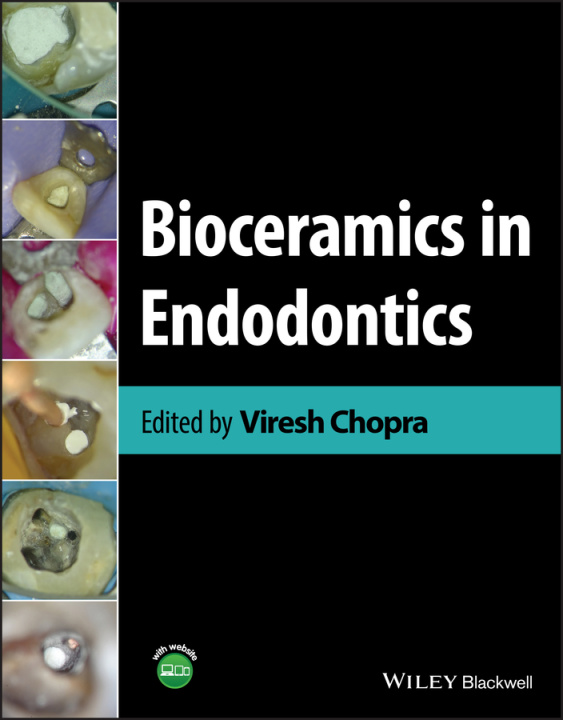 Kniha Clinical Atlas on Bioceramics in Endodontics 