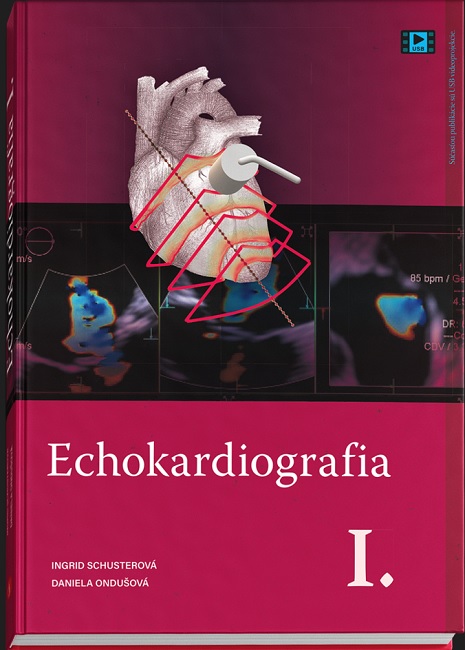 Carte Echokardiografia I. Ingrid Schusterová