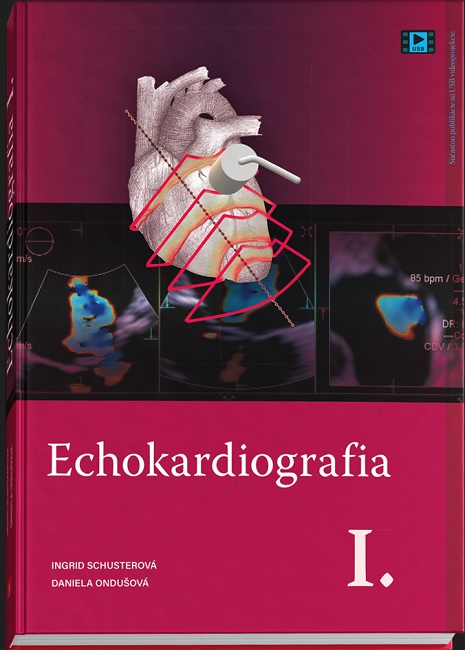 Książka Echokardiografia I. Ingrid Schusterová