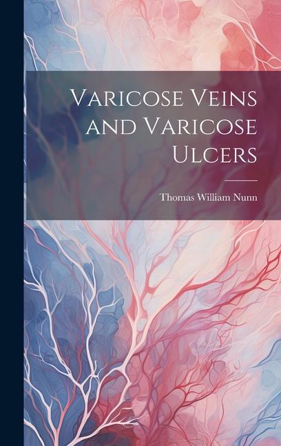 Livre Varicose Veins and Varicose Ulcers 