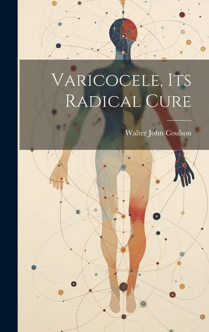 Könyv Varicocele, Its Radical Cure 