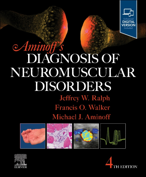 Kniha Aminoff's Diagnosis of Neuromuscular Disorders Michael J. Aminoff