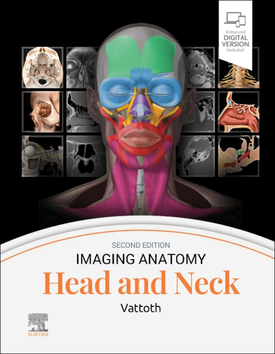 Libro Imaging Anatomy: Head and Neck Surjith Vattoth