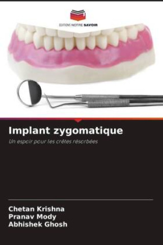 Könyv Implant zygomatique Pranav Mody