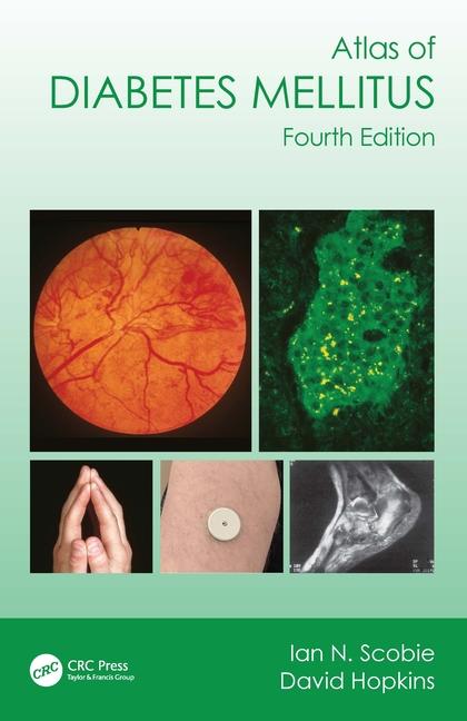 Kniha Atlas of Diabetes Mellitus Scobie