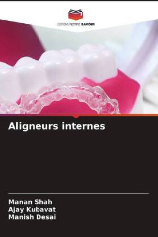 Knjiga Aligneurs internes Manan Shah
