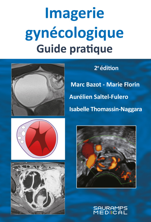 Kniha Imagerie gynécologique. Guide pratique 2ed Thomassin-Naggara