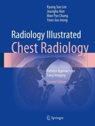 Kniha Radiology Illustrated: Chest Radiology Kyung Soo Lee