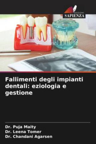 Kniha Fallimenti degli impianti dentali: eziologia e gestione Leena Tomer
