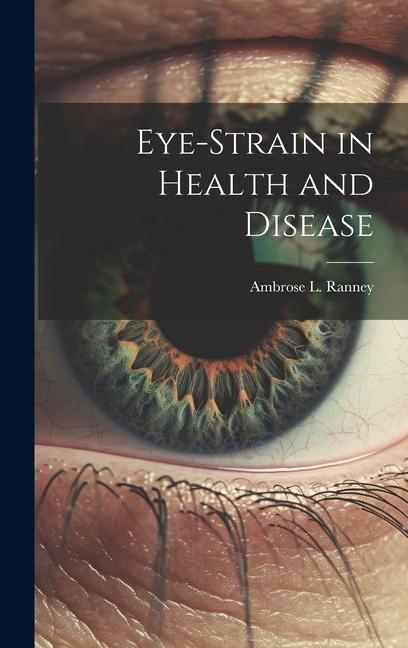 Kniha Eye-Strain in Health and Disease 