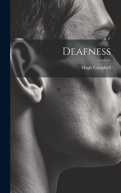 Knjiga Deafness Hugh Campbell
