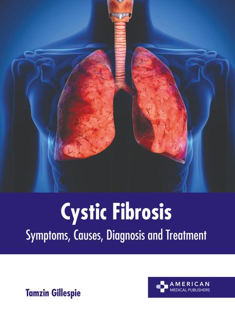 Kniha Cystic Fibrosis: Symptoms, Causes, Diagnosis and Treatment 