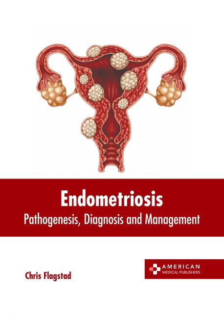 Книга Endometriosis: Pathogenesis, Diagnosis and Management 