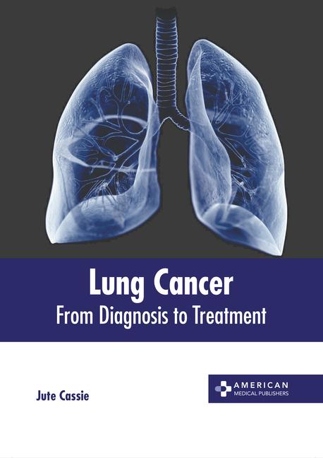 Carte Lung Cancer: From Diagnosis to Treatment 