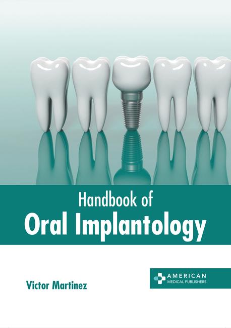 Könyv Handbook of Oral Implantology 