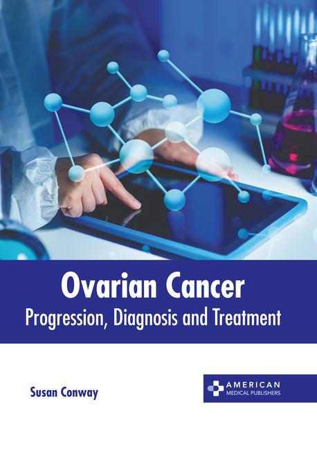 Kniha Ovarian Cancer: Progression, Diagnosis and Treatment 