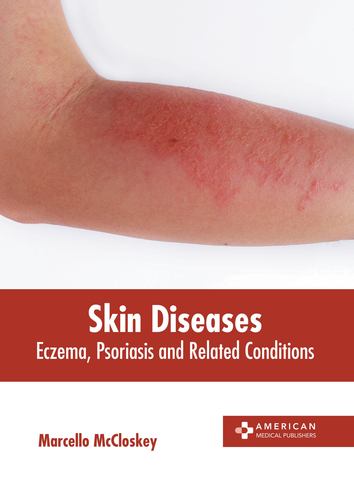 Książka Skin Diseases: Eczema, Psoriasis and Related Conditions 