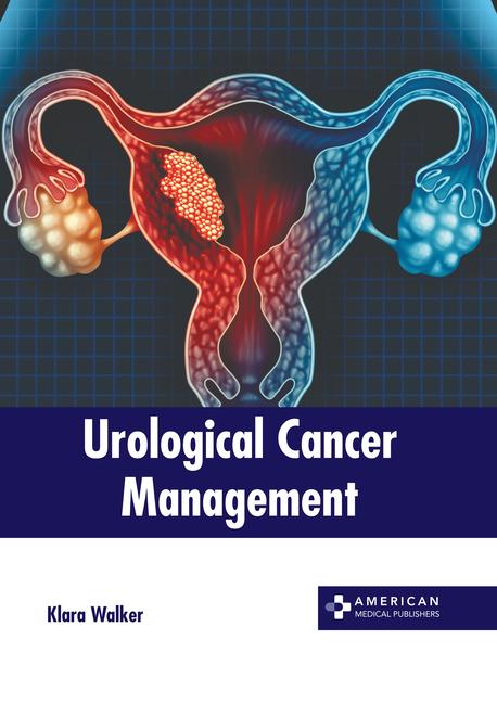 Buch Urological Cancer Management 