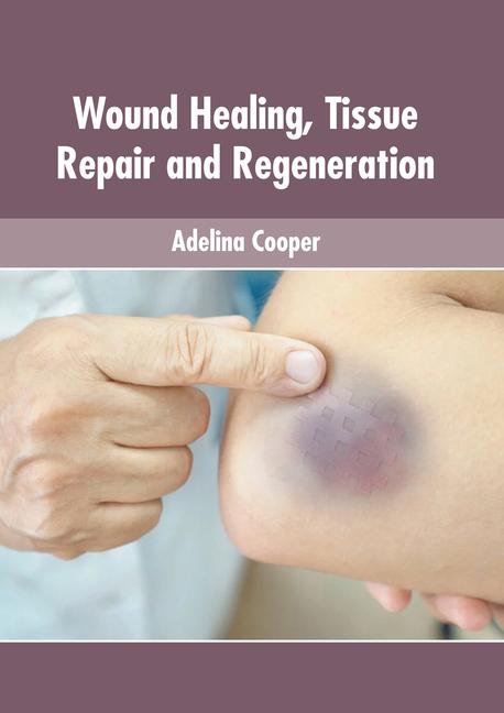 Книга Wound Healing, Tissue Repair and Regeneration 