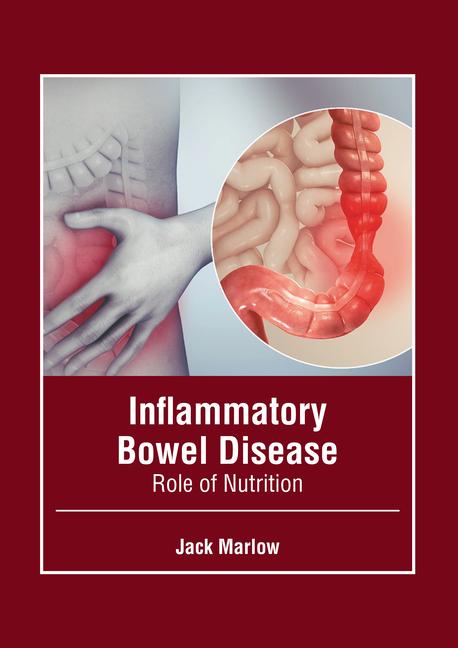 Carte Inflammatory Bowel Disease: Role of Nutrition 