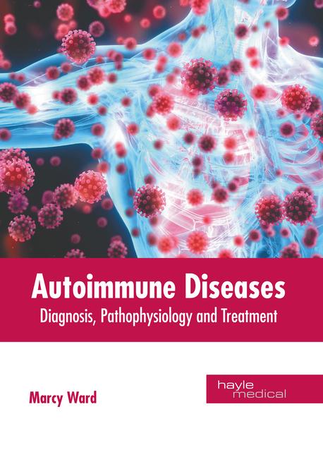 Knjiga Autoimmune Diseases: Diagnosis, Pathophysiology and Treatment 