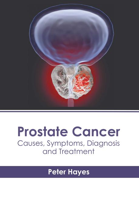 Libro Prostate Cancer: Causes, Symptoms, Diagnosis and Treatment 