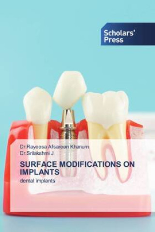 Knjiga SURFACE MODIFICATIONS ON IMPLANTS Srilakshmi J