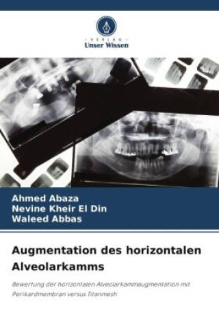 Boek Augmentation des horizontalen Alveolarkamms Nevine Kheir El Din