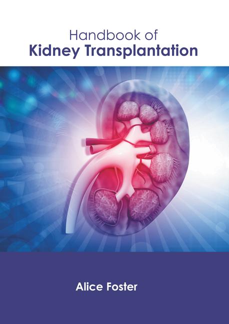 Könyv Handbook of Kidney Transplantation 
