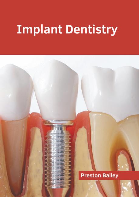 Libro Implant Dentistry 