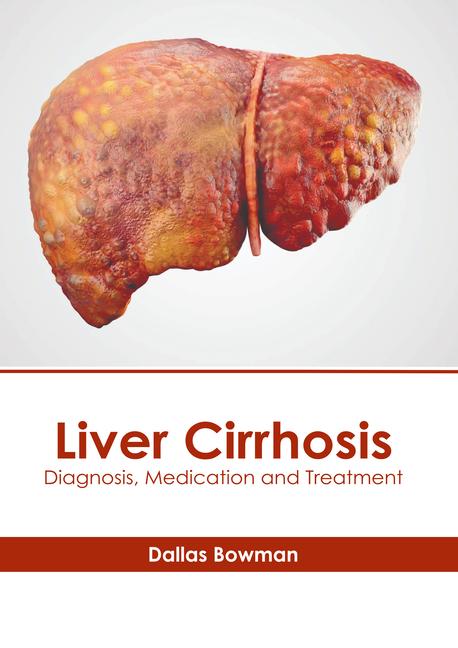 Kniha Liver Cirrhosis: Diagnosis, Medication and Treatment 