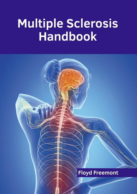 Kniha Multiple Sclerosis Handbook 