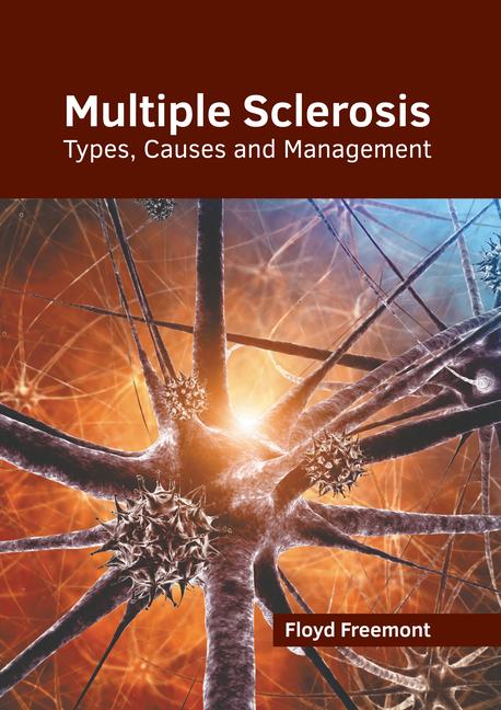 Kniha Multiple Sclerosis: Types, Causes and Management 