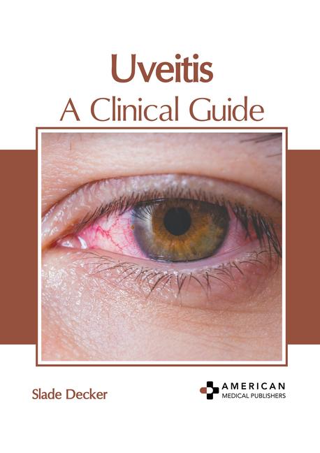 Könyv Uveitis: A Clinical Guide 