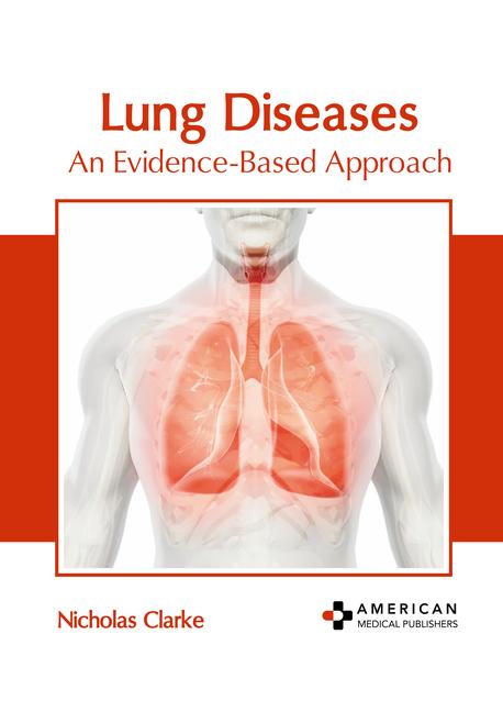 Книга Lung Diseases: An Evidence-Based Approach 