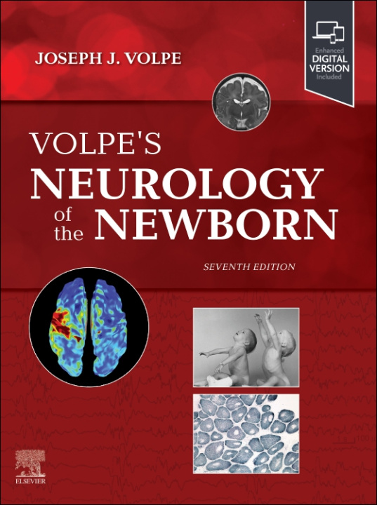 Книга Volpe's Neurology of the Newborn Joseph J. Volpe