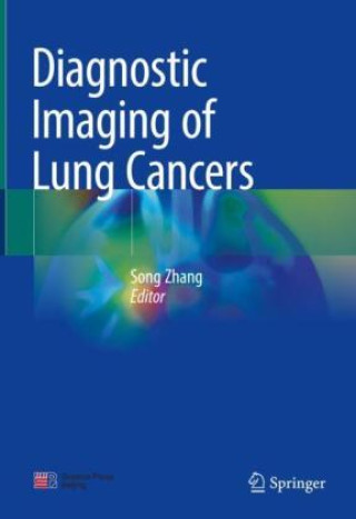 Book Diagnostic Imaging of Lung Cancers Song Zhang