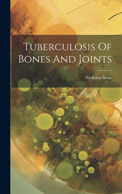 Könyv Tuberculosis Of Bones And Joints 