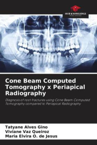 Kniha Cone Beam Computed Tomography x Periapical Radiography Viviane Vaz Queiroz