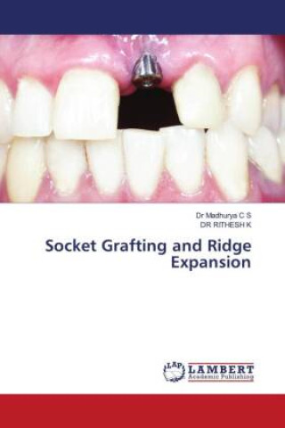 Книга Socket Grafting and Ridge Expansion Rithesh K