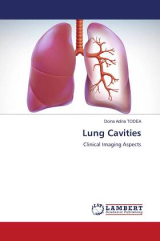 Knjiga Lung Cavities Doina Adina Todea