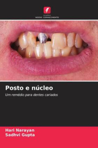 Boek Posto e núcleo Hari Narayan