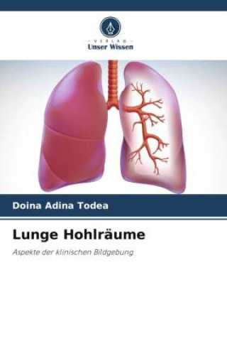 Knjiga Lunge Hohlräume Doina Adina Todea